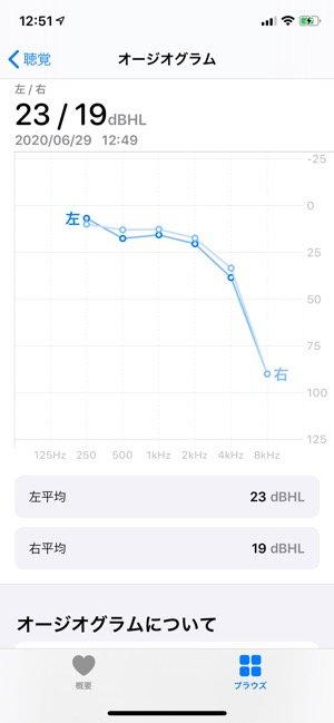 ヘルスケア 連携 聴力 聴覚