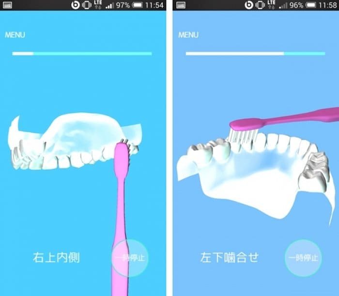 現役歯科医が娘のために作った 本気の歯みがきアプリ登場 本格的なのにゲーム感覚で継続できる アプリオ 現役歯科医が娘のために作った 本気の歯みがきアプリ登場 本格的なのにゲーム感覚で継続できる アプリオ