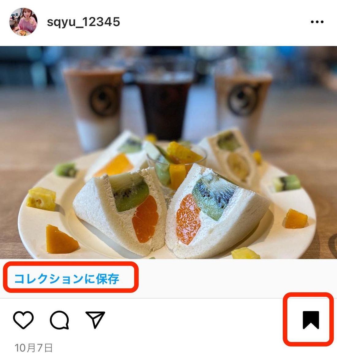 投稿の写真・動画の保存(コレクション・ダウンロード)