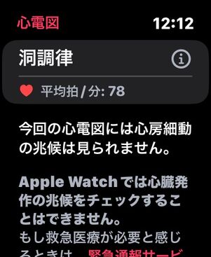 心電図を計測可能